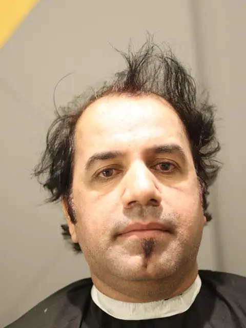 Client before his hair system
