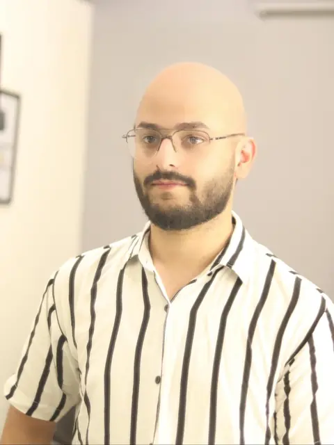 Client before his hair system