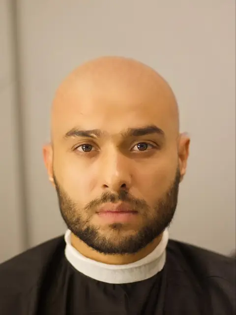 Client before his hair system