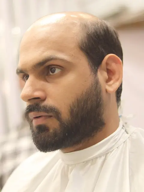 Client before his hair system