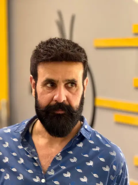 Same client after his hair system fitting