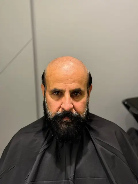 Client before his hair system